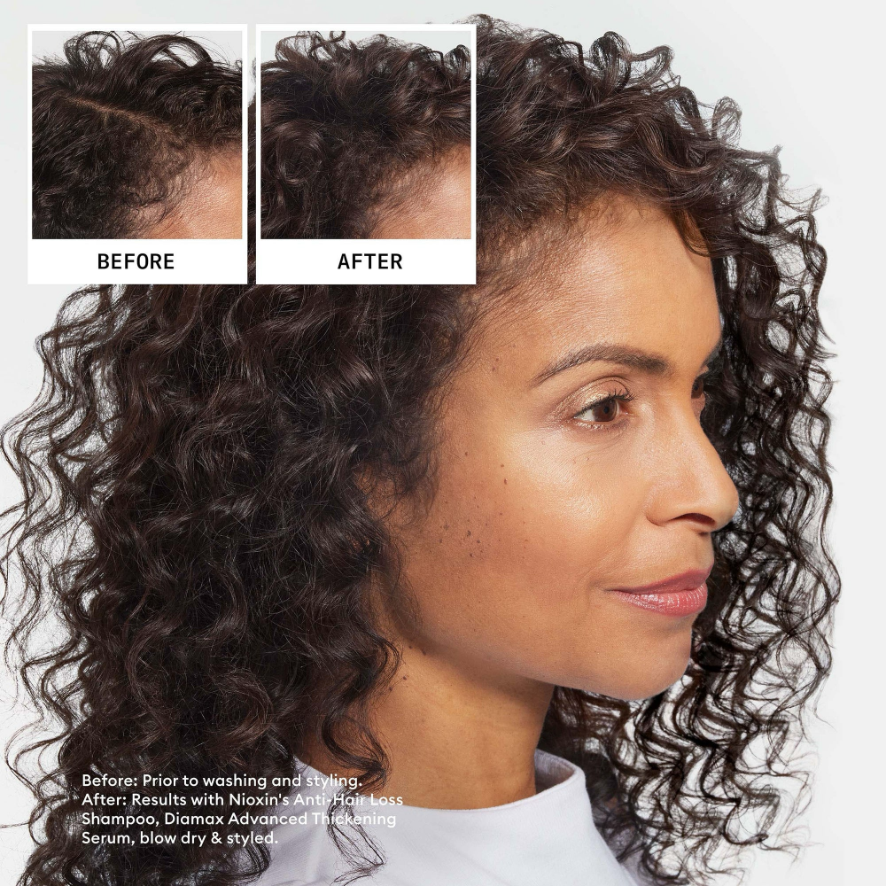 Nioxin Anti Hair Loss Shampoo 240ml